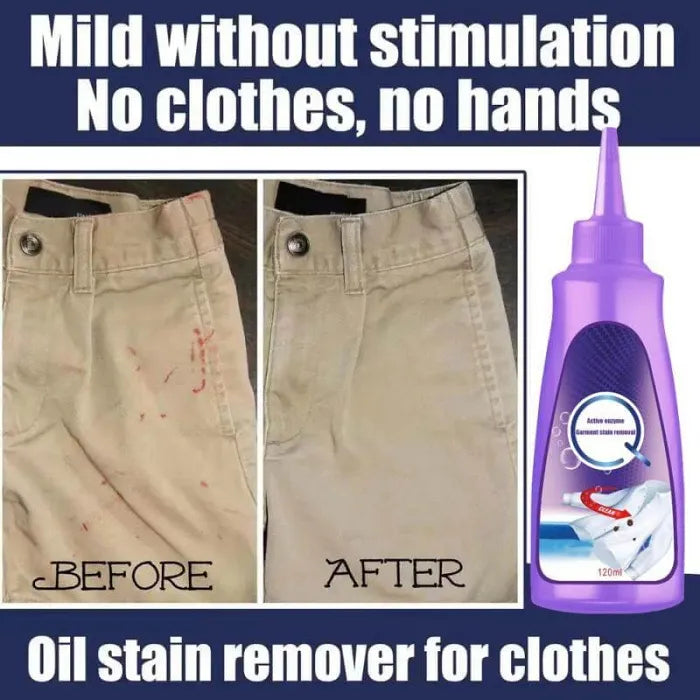 Laundry Stain Remover (70% OFF)